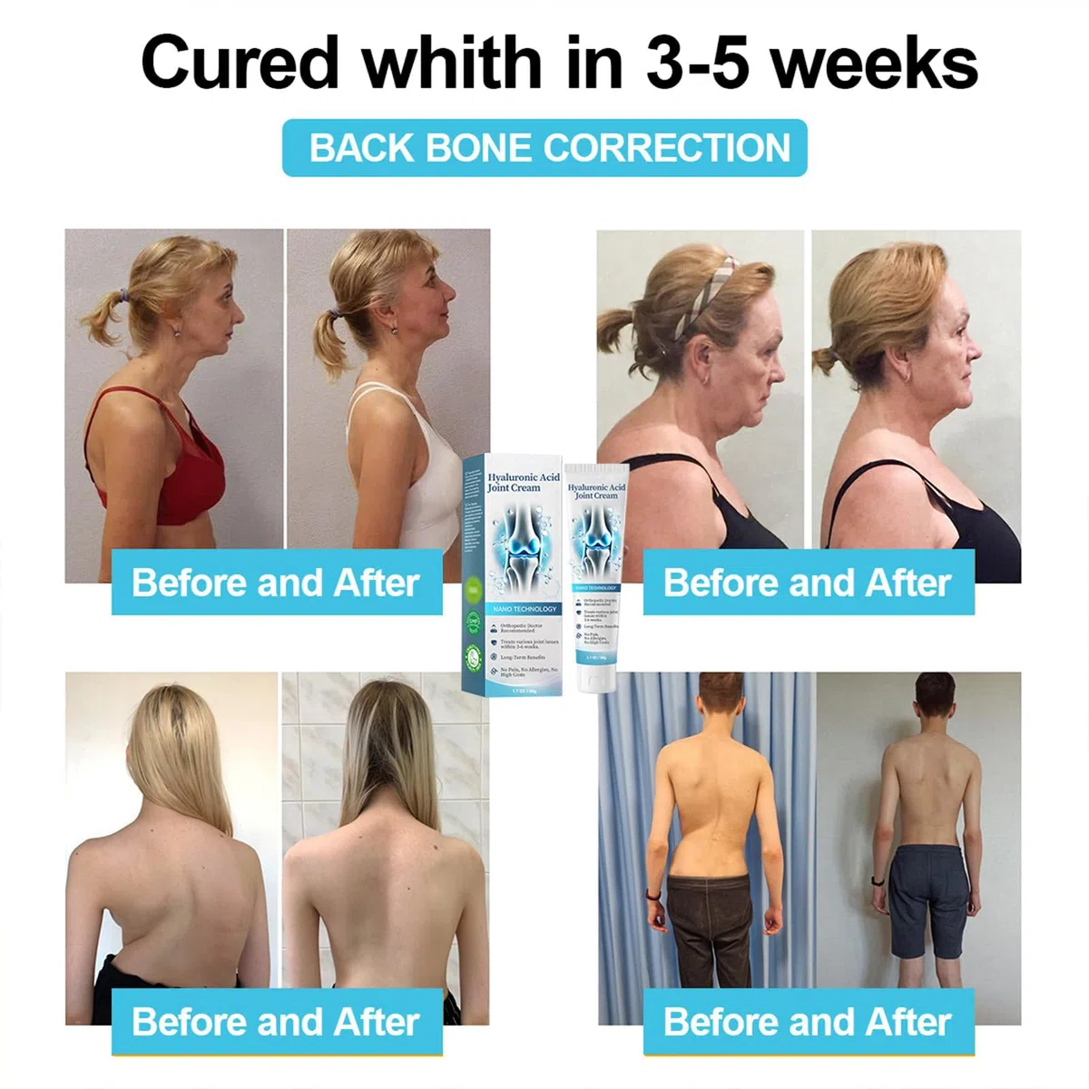 ArthroHeal, crema R-epair per articolazioni, ArthroHeal Ar-thritis P-ain R-elief, crema avanzata per la cura delle articolazioni e delle ossa, crema T-herapia per schiena, collo, mani, ginocchia (3)