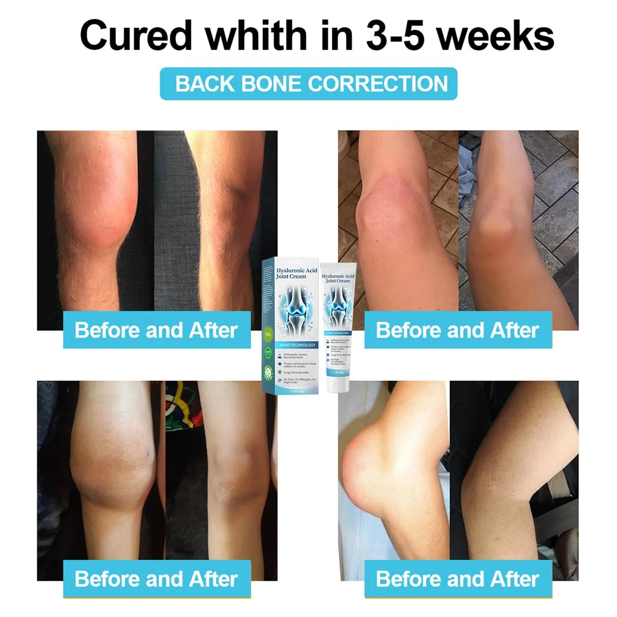 ArthroHeal, crema R-epair per articolazioni, ArthroHeal Ar-thritis P-ain R-elief, crema avanzata per la cura delle articolazioni e delle ossa, crema T-herapia per schiena, collo, mani, ginocchia (3)